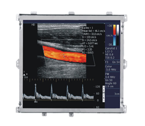 15寸超声医用显示器