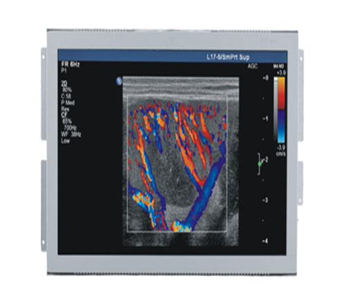 17寸超声图像显示器