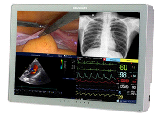 42寸高清手术医用显示器