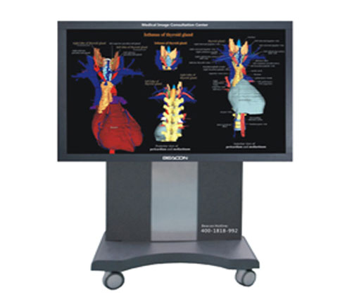 55寸医用会诊大屏