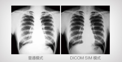 DICOM SIM模式 - Epson CB-G7100产品功能